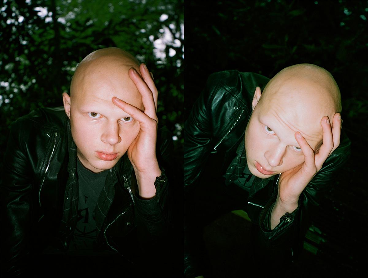 Meet Sam Collet The 18 Year Old Rick Owens Model With Alopecia Read I D