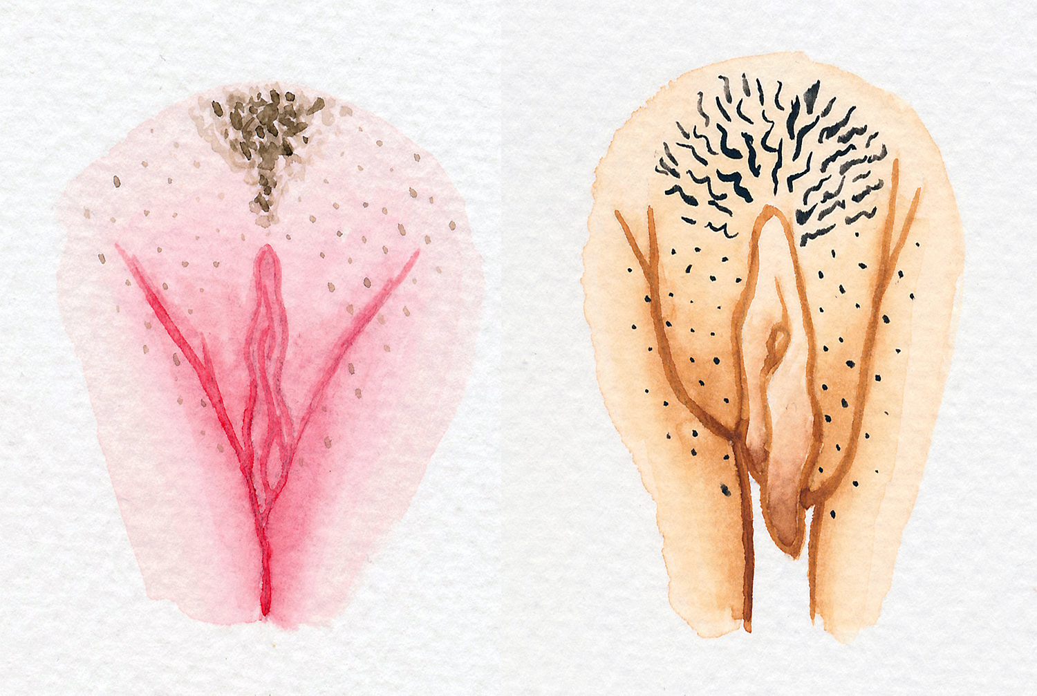 Vaginas verschiedene Vagina Formen: